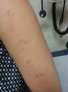 arm_allergy_test
